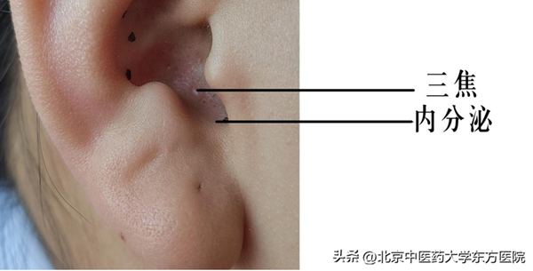 4a3ea551a2604cc78dc8df125d66715d~noop.png 4a3ea551a2604cc78dc8df125d66715d~noop.png