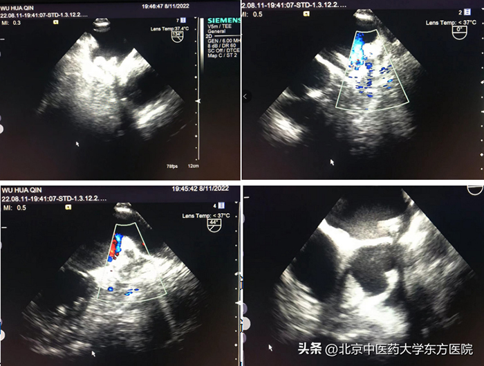 微信图片_20220815154023.jpg 微信图片_20220815154023.jpg