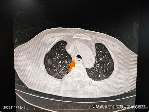 微信图片_20221123132447.jpg 微信图片_20221123132447.jpg
